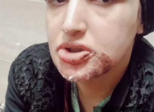 القبض على زوج اعتدى على زوجته بالضرب المبرح